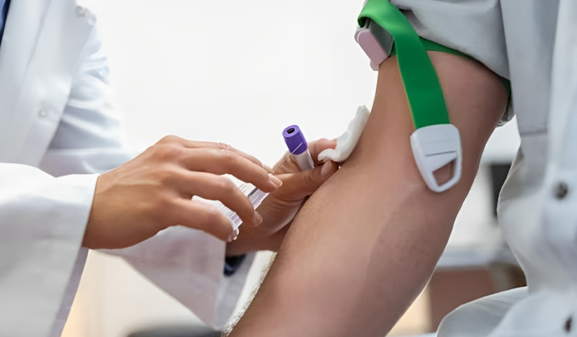 NAD+ IV therapy Chicago