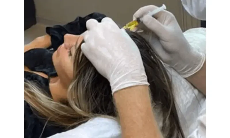 hair loss treatment in Istanbul