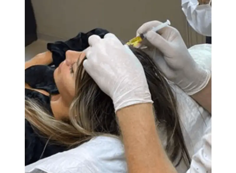 hair loss treatment in Istanbul